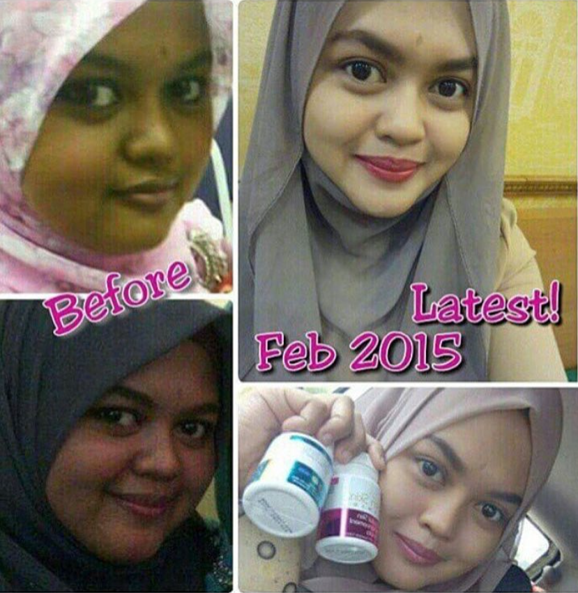 Satinskinzpremium changes in skin tone so 5x whitening